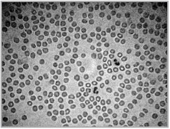 рис. 100. красные кровяные тельца (эритроциты) под микроскопом
